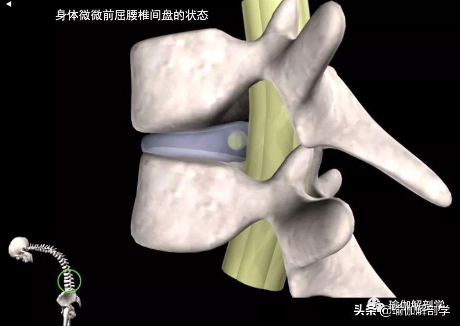 腰椎间盘突出症的锻炼方法图片_锻炼腰间盘突出的图片_锻炼腰椎间盘突出的图片