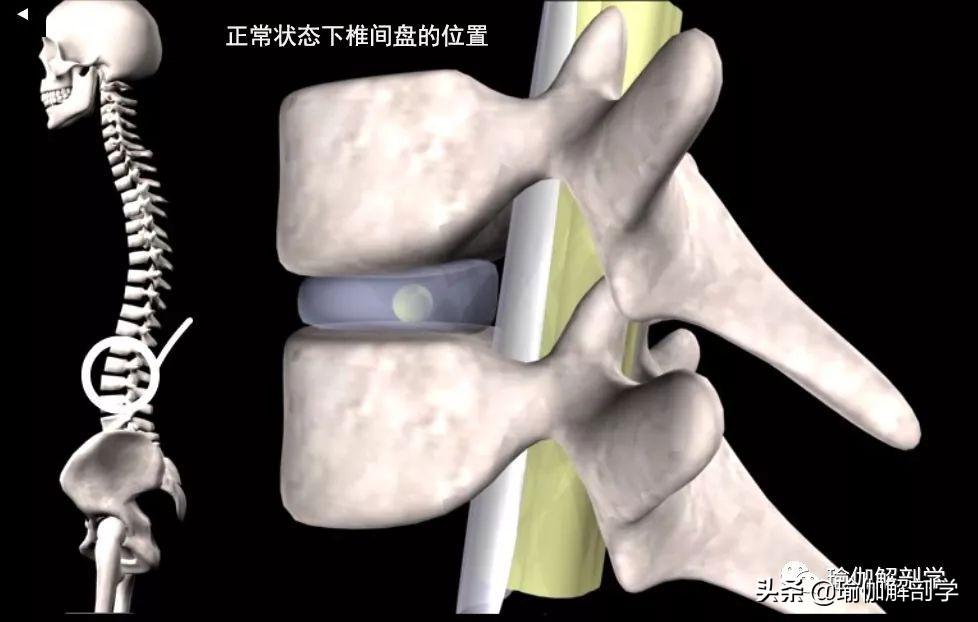 锻炼腰间盘突出的图片_腰椎间盘突出症的锻炼方法图片_锻炼腰椎间盘突出的图片