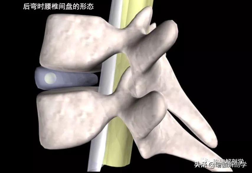 锻炼腰间盘突出的图片_腰椎间盘突出症的锻炼方法图片_锻炼腰椎间盘突出的图片