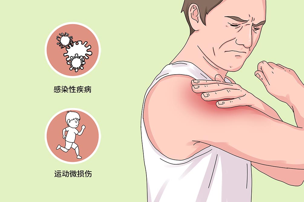 肌肉锻炼休息间隔_肌肉锻炼间隔_间隔肌肉锻炼休息多久